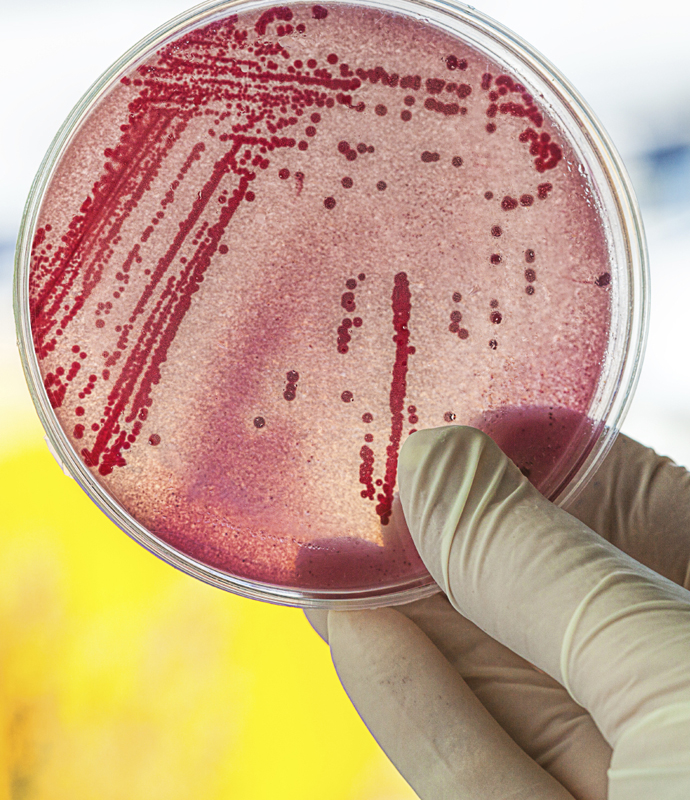 Air-Sampling-for-Bacteria